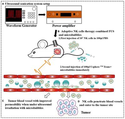 Focused Ultrasound Improves NK-92MI Cells Infiltration Into Tumors